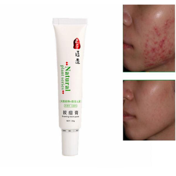CAICUI Anti Acne Cream Oil Control Shrink Pores Pimple Scar Remove Face Care 30g